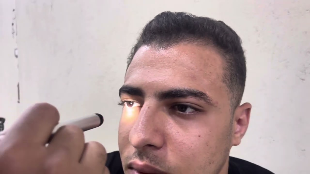 Light pupillary reflex