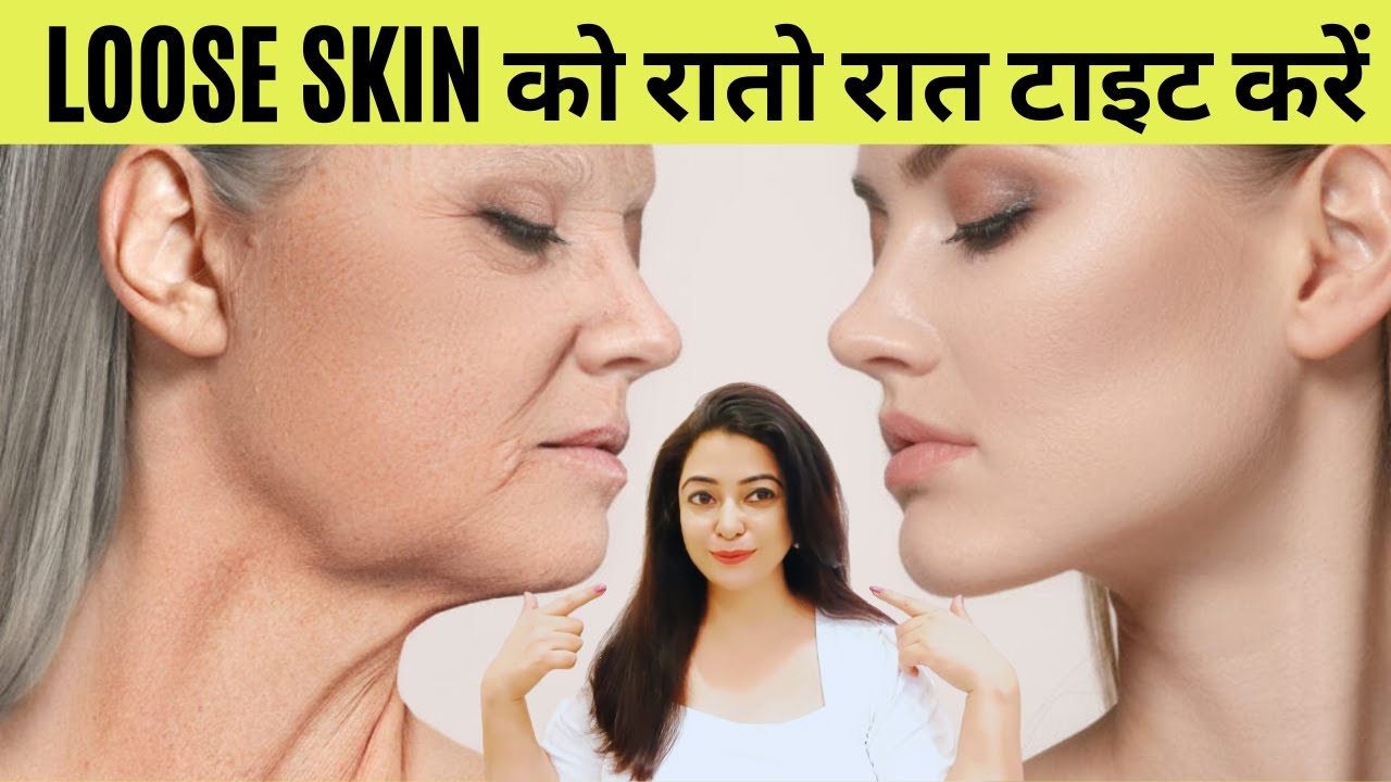 चेहरा गुलाब जैसा खिल उठेगा - ढीली लटकी बेजान स्किन में डालें एक नयी जान । स्किन टाइट करने के 4 उपाय