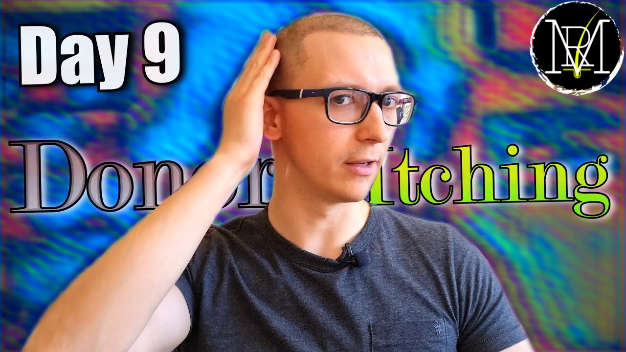 День 9 после пересадки волос методом FUE/DHI. Зуд и как с ним бороться.