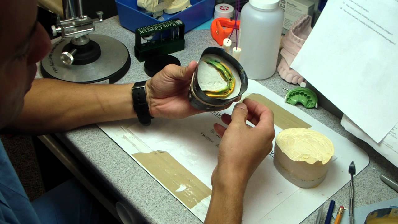 Final Denture Impression Part 2: Boxing with a Panoramic Radiograph- No wax, mo mess.
