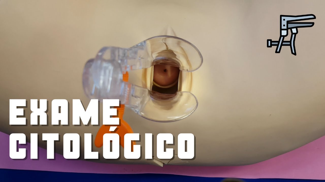 Exame de Papanicolau - Prática Médica - Medicina UNILA