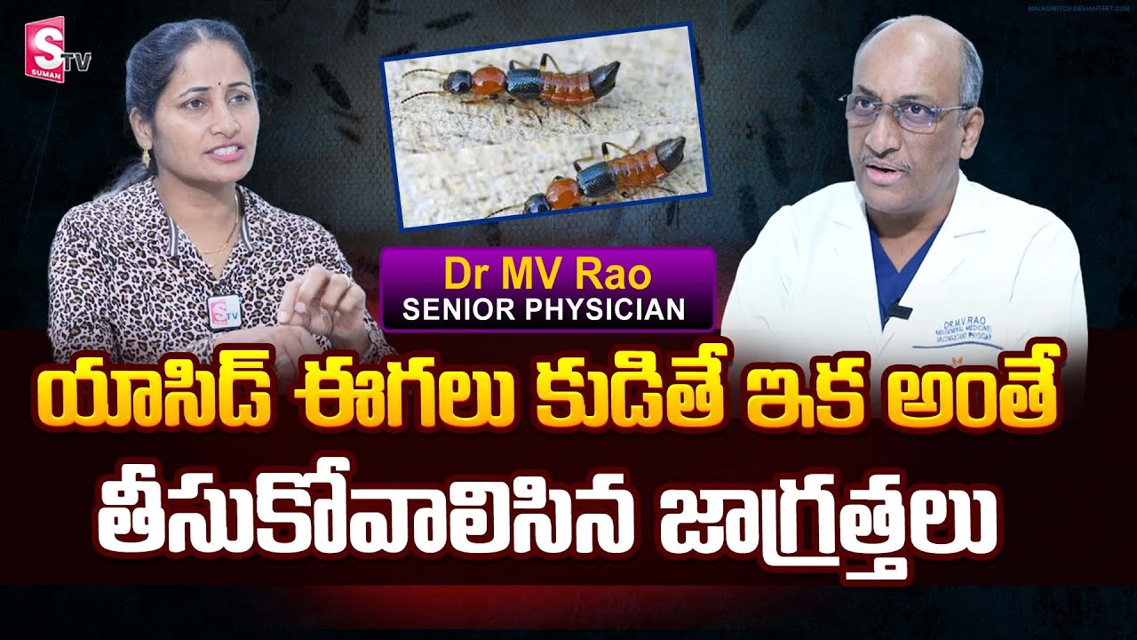 Senior Physician Dr MV Rao About Nairobi Infections | Acid Flies | SumanTV