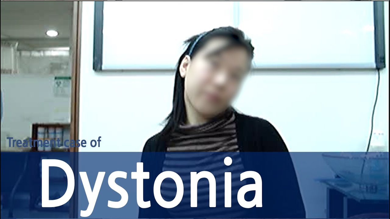 Dystonia/Cervical dystonia/Spasmodic Torticollis /  사경증 치료사례 / 근긴장이상증