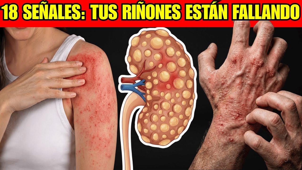 Nefrólogo Advierte: 18 Señales de Daño Renal - (Detéctalas A Tiempo)
