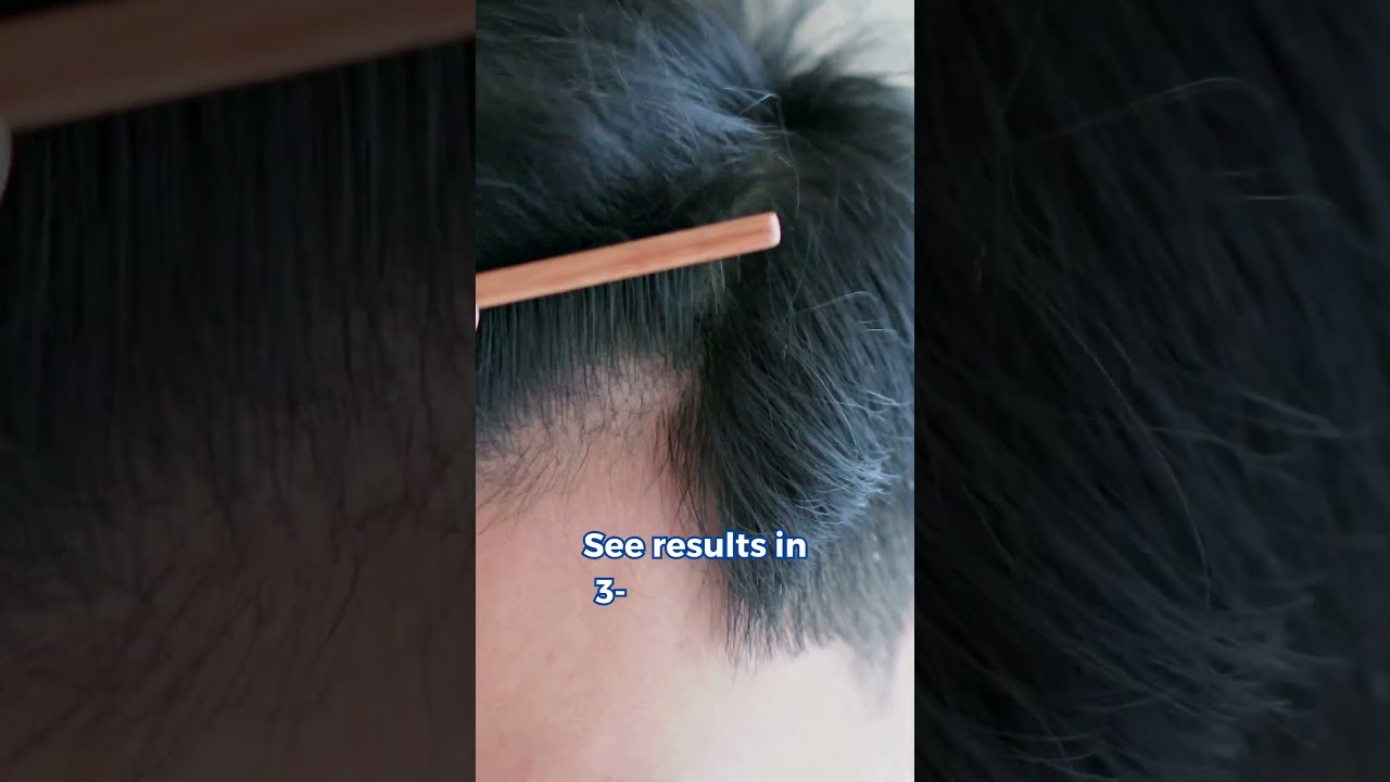 My Hair Loss Prevention Routine  