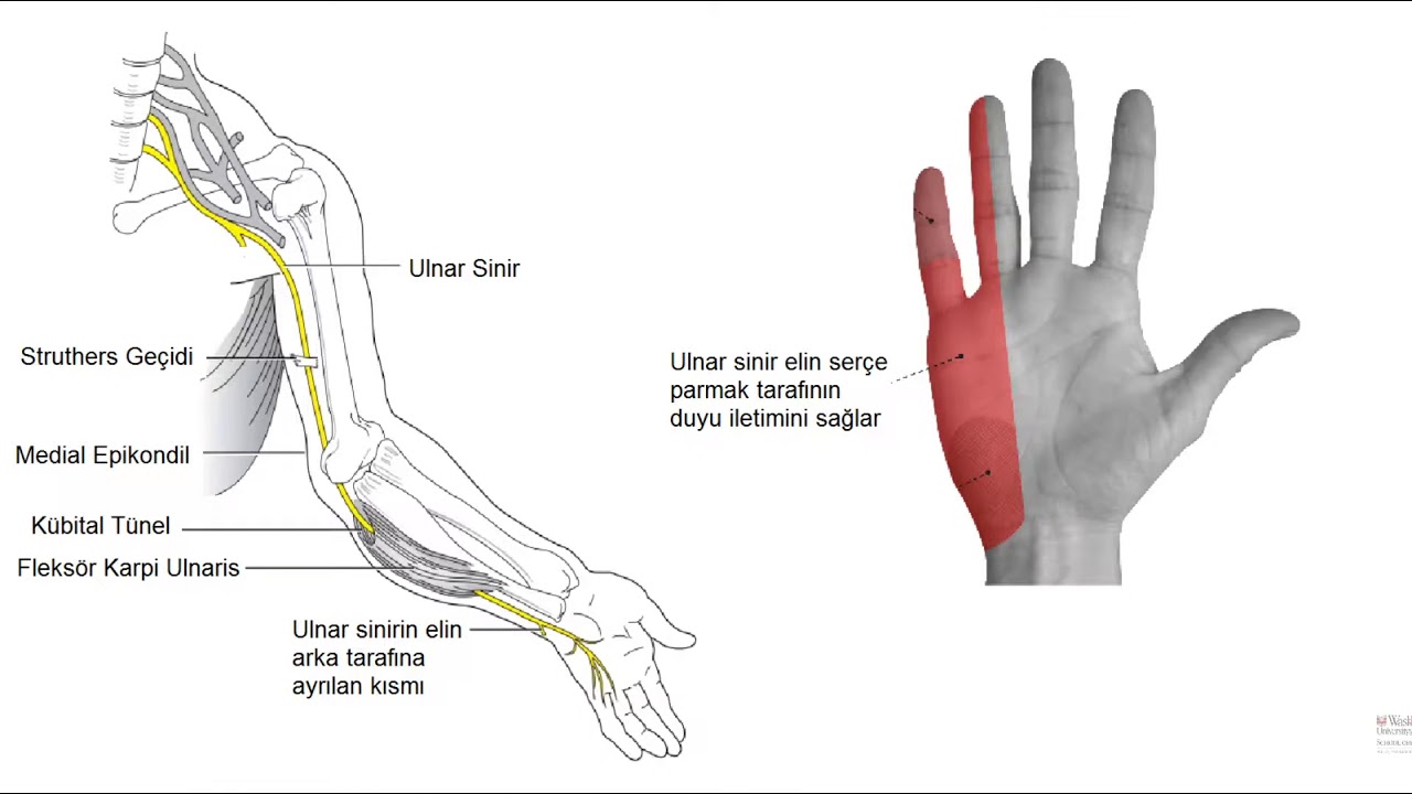 Kolda dirsekte elde ağrı ve uyuşma ulnar sinir sıkışma nöropatileri