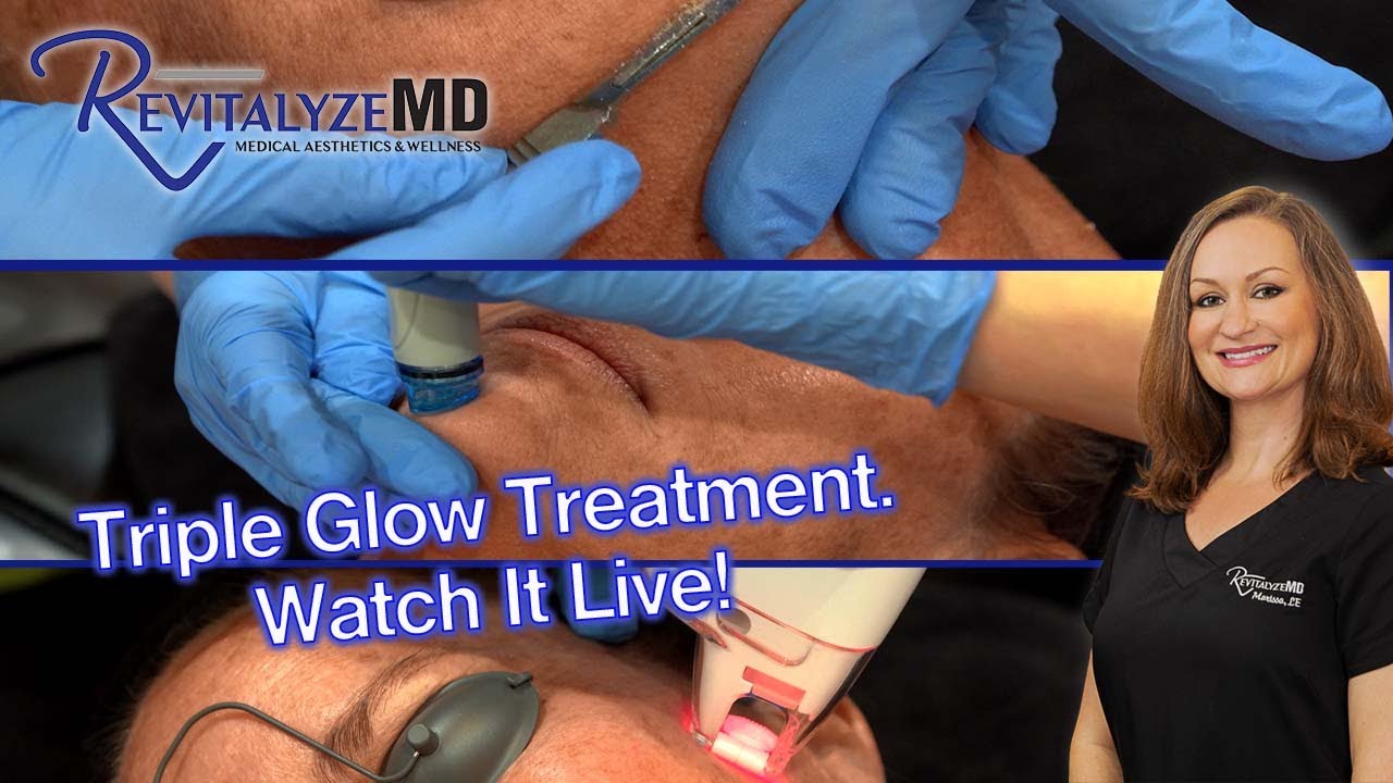 Triple glow treatment only at RMD!  Look at this amazing three in one treatment!!  Tell us Marissa!