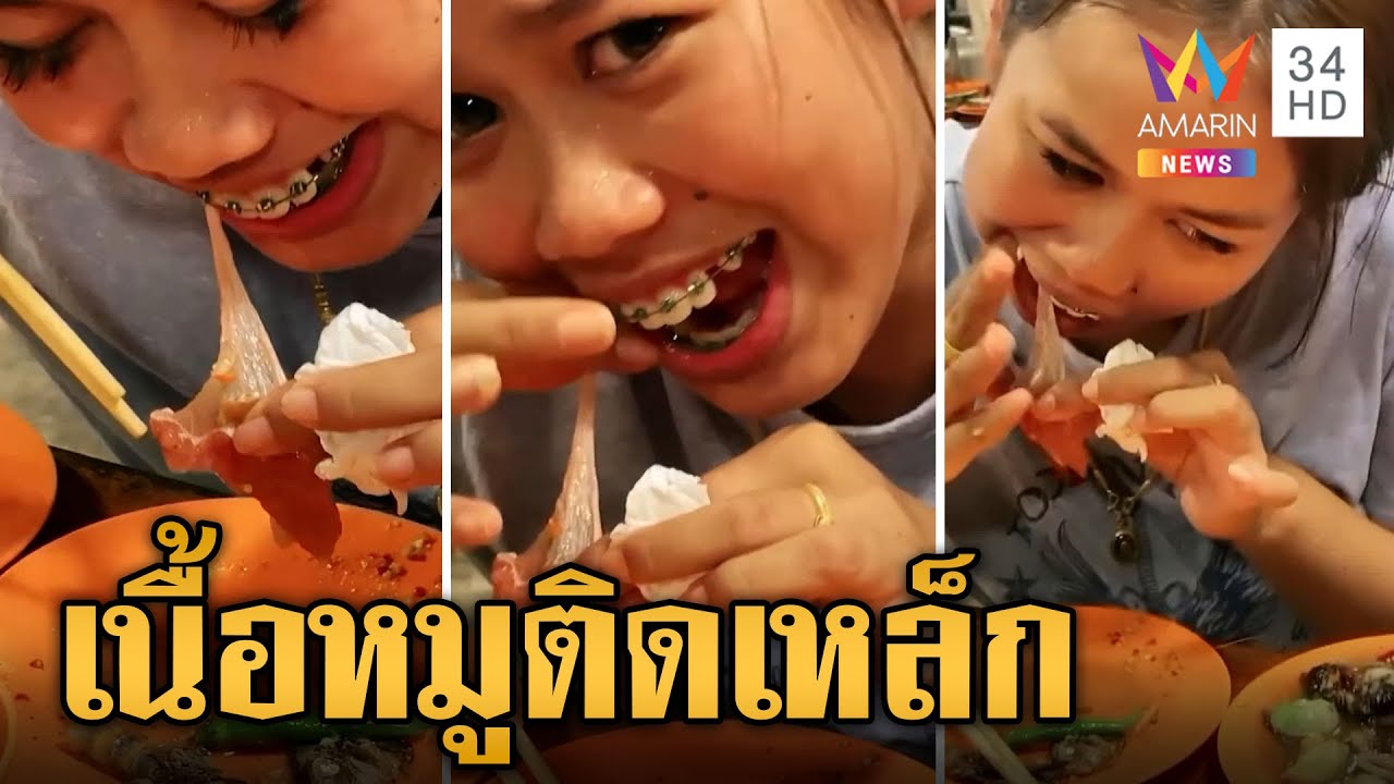 สาวดัดฟันกินหมูกระทะ เนื้อหมูติดเหล็กเอาออกไม่ได้