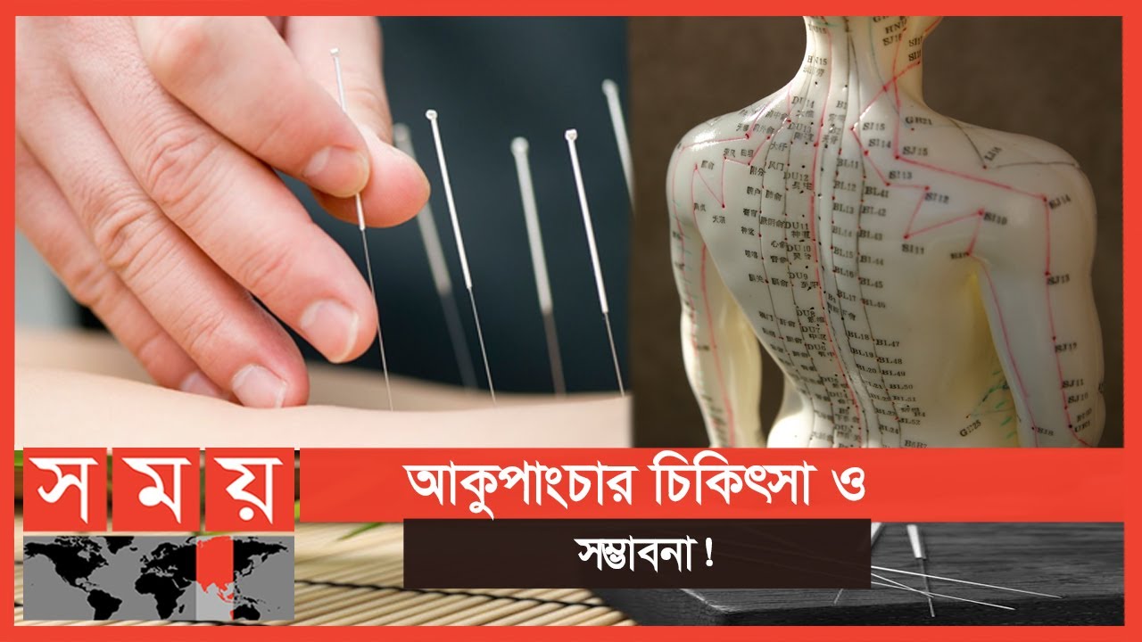 'বন্ধ্যাত্বের ক্ষেত্রেও কার্যকর আকুপাংচার' | বদ্যি বাড়ি | Acupuncture Treatment |Health Tips