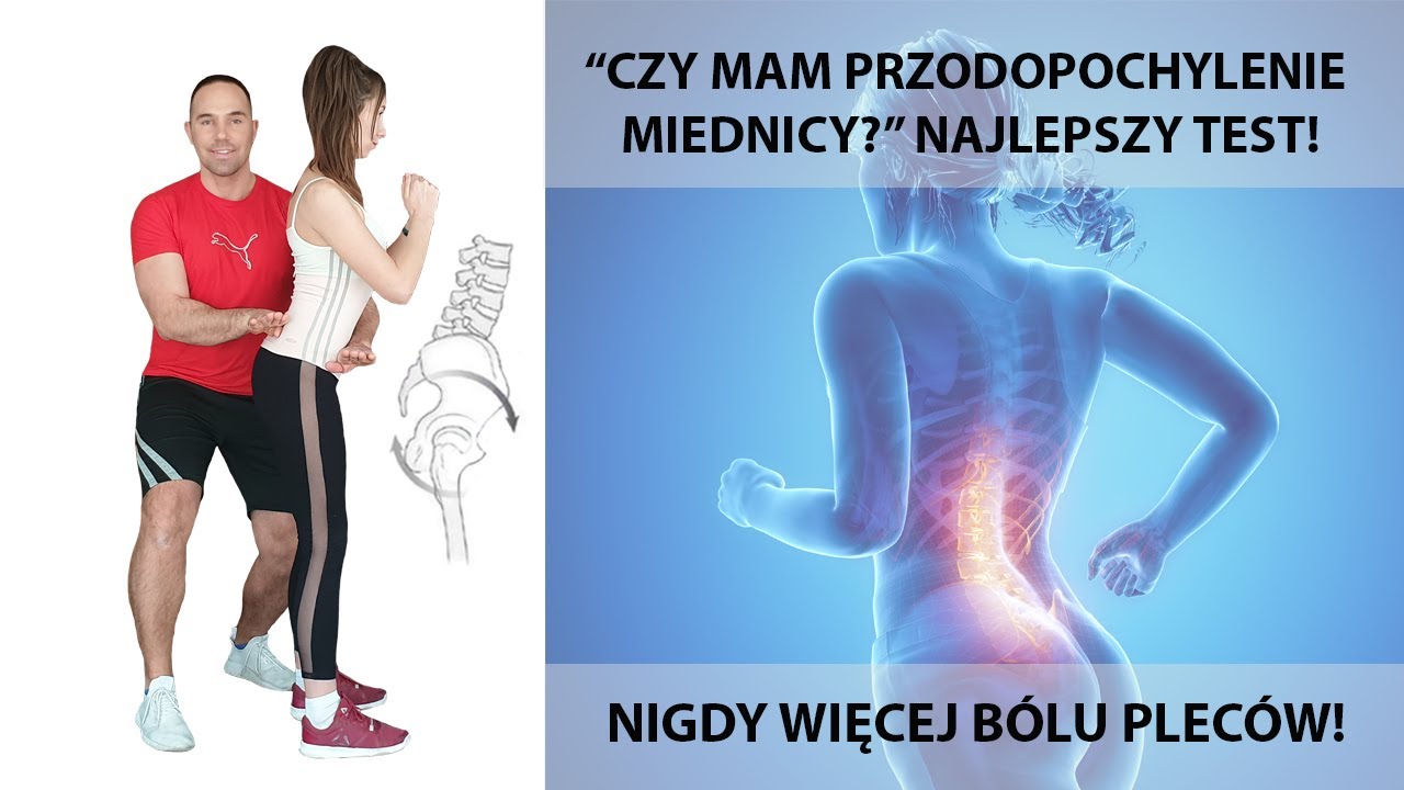 Sprawdź, czy masz nadmierne przodopochylenie miednicy. Dowiedz się dlaczego bolą Cię plecy.