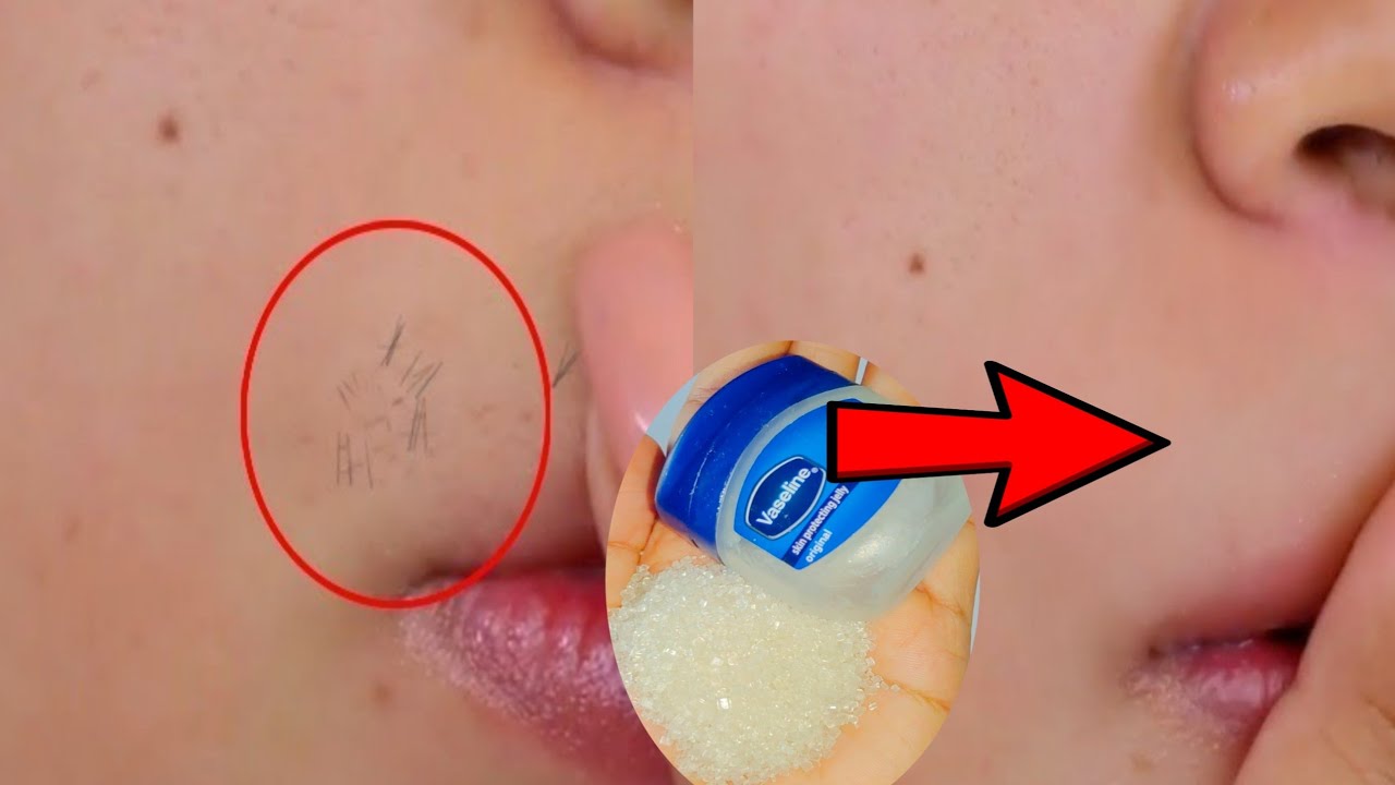 Vaseline for upper lip hair removal cream  | Vaseline for remove Facial hair permanently