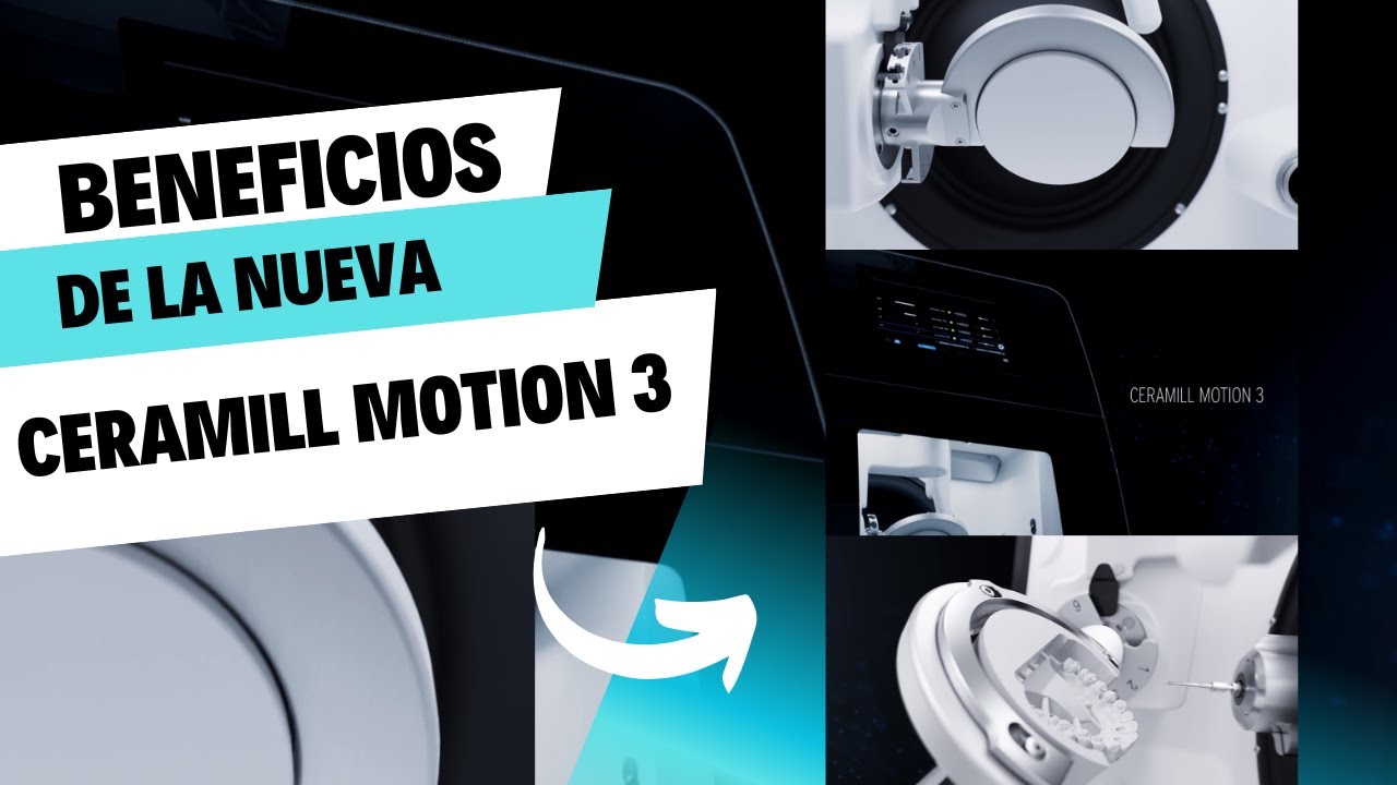 BENEFICIOS DE LA CERAMILL MOTION 3
