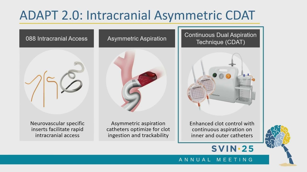 SVIN 2025: Is it Time for ADAPT 2.0? Real-World Continuous Dual AspiraTion with the Zoom System