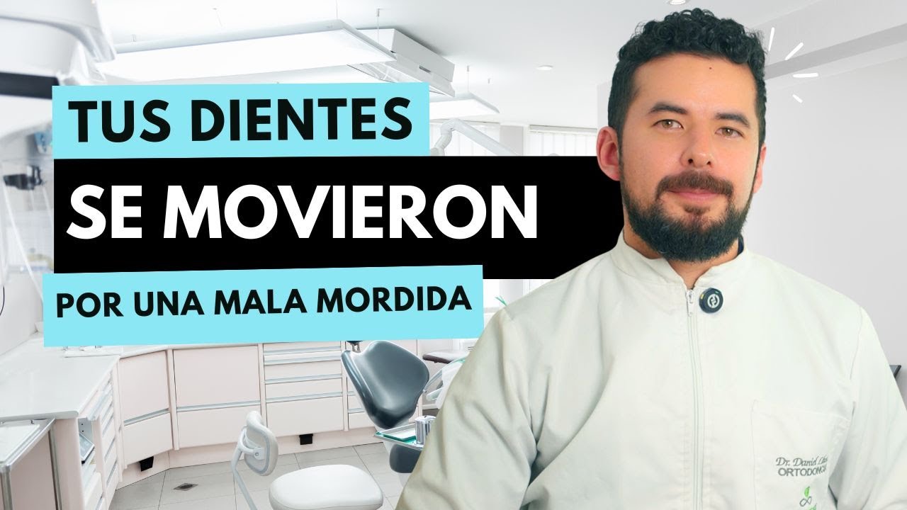 Tipos de mordida dental y cómo corregirlas | Evita que tus dientes se muevan otra vez