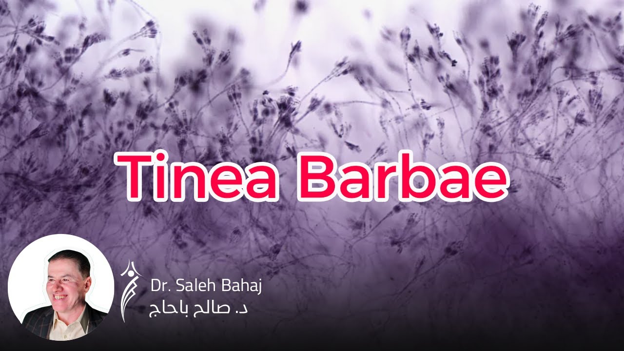 6. Tinea barbae