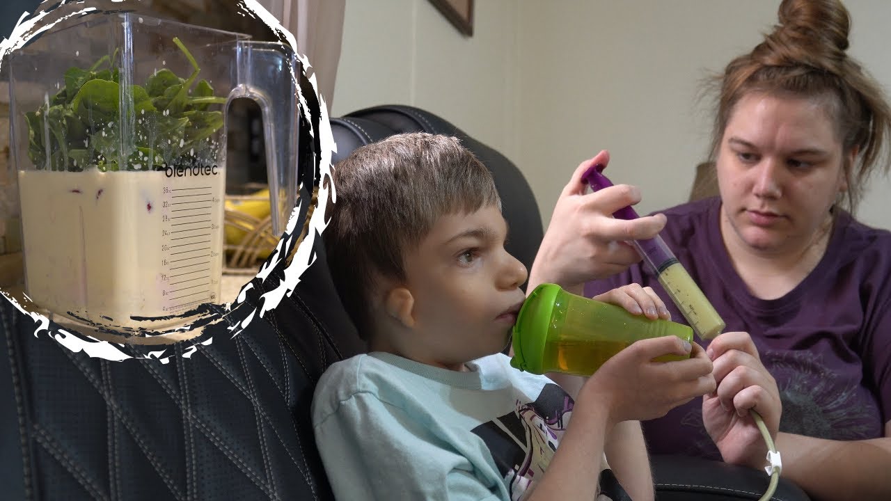 Why We Tube Feed Our Special Needs Son