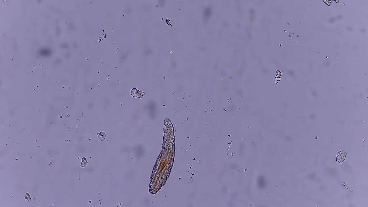 Rot&iacute;feros bajo el microscopio | Ciencia ilustrada