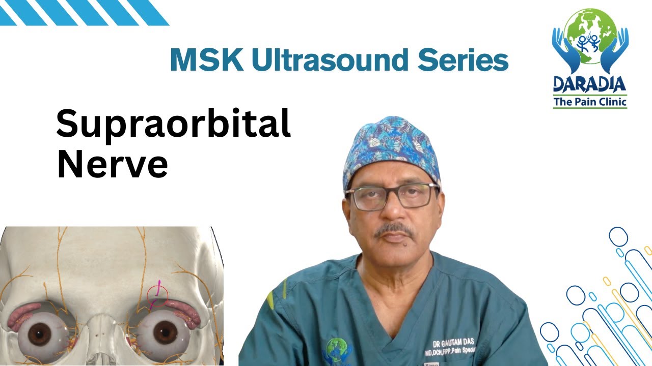 Supraorbital Nerve Block: 3D Anatomy, Sonoanatomy & Probe Positioning for Pain Physicians