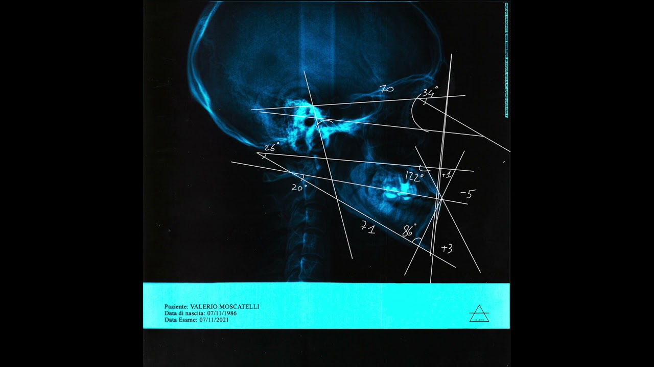 Valerio Moscatelli - Test 1 [Eklero]