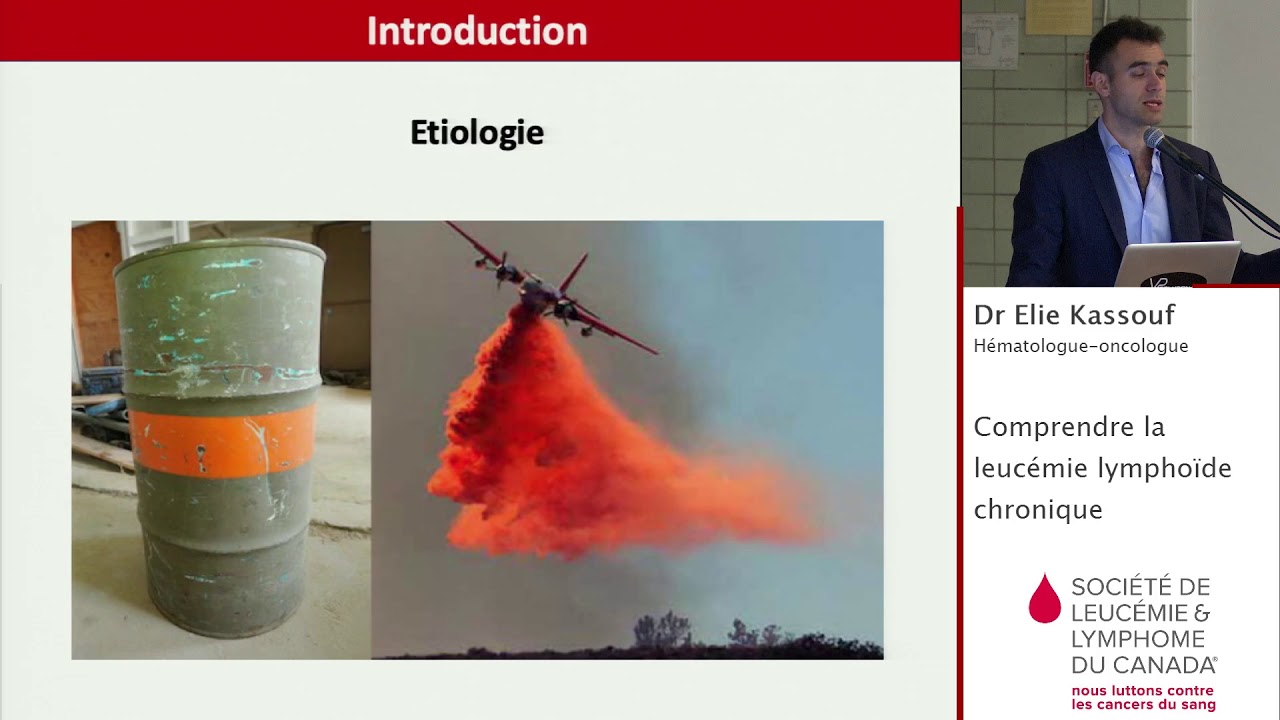 Comprendre la leucémie lymphoïde chronique