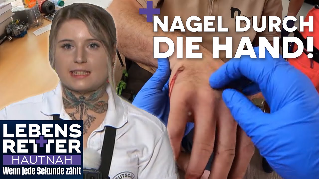 Schmerzhafter Arbeitsunfall & großes Glück im Unglück | Lebensretter hautnah | SAT.1