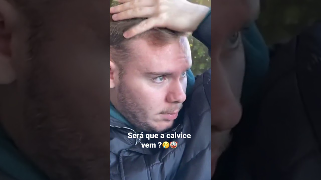 Calvice chegando*🤧 #humor #calvice #calvosexy #careca #shorts #comedy #reels #cabelo #triste #sad