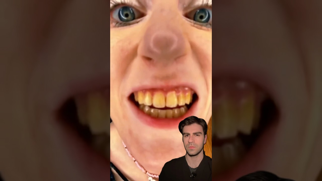 Fix These YELLOW Teeth