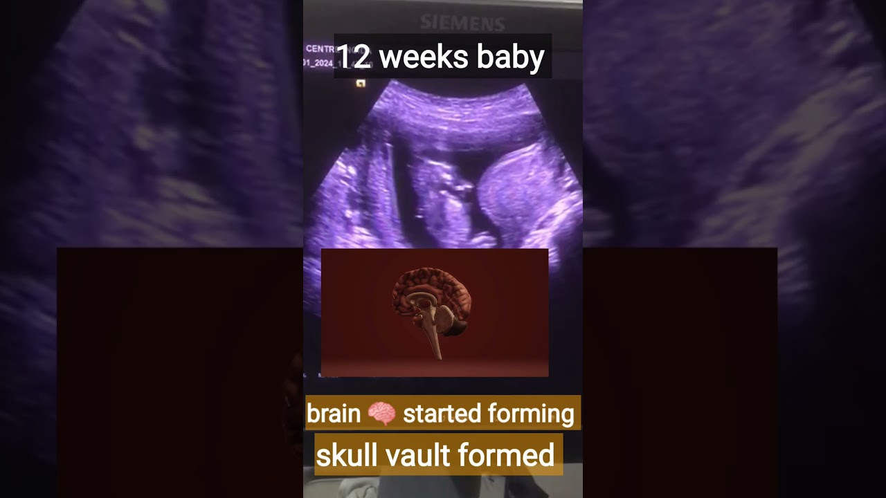 3 months baby on ultrasound/ 12 weeks baby
