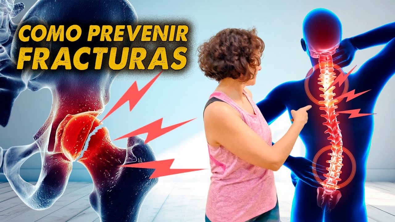 ASÍ EVITARÁS el 80% de las FRACTURAS con OSTEOPOROSIS  🦴