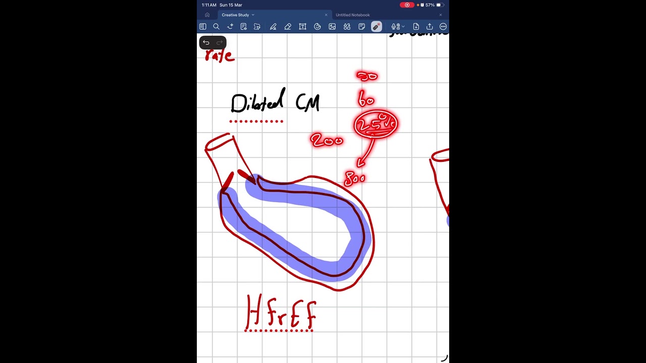 Ejection fraction - cardiac output - stroke volume made easy 
