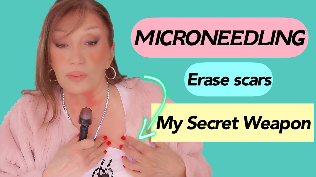 Microneedling: My Hidden Trick for Youthful Skin /OhCarolShow