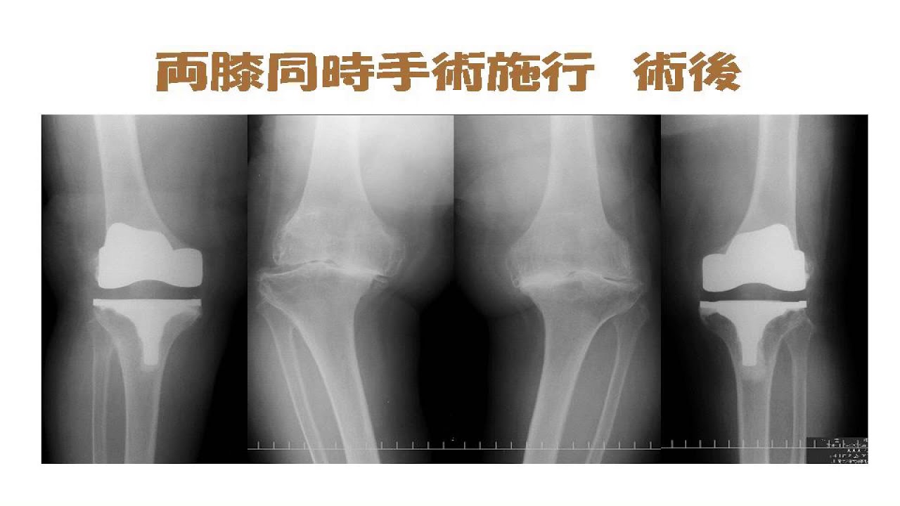 【MEDICA】川崎医科大学附属病院　整形外科　難波良文部長