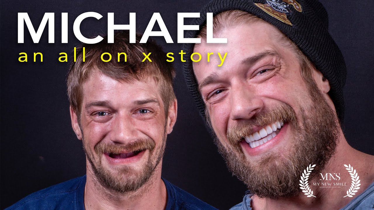 Michael's Full All on X Journey | Emotional Smile Reveal