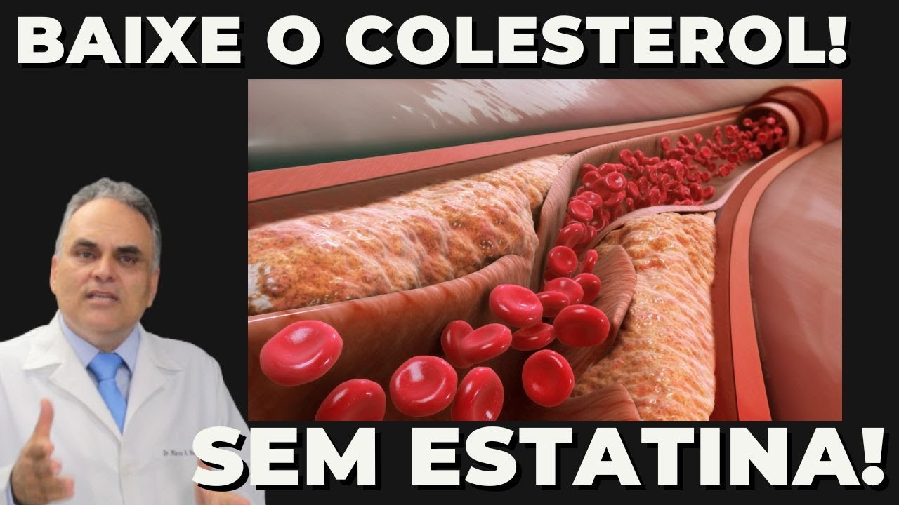 Baixe o colesterol sem rem&eacute;dio!