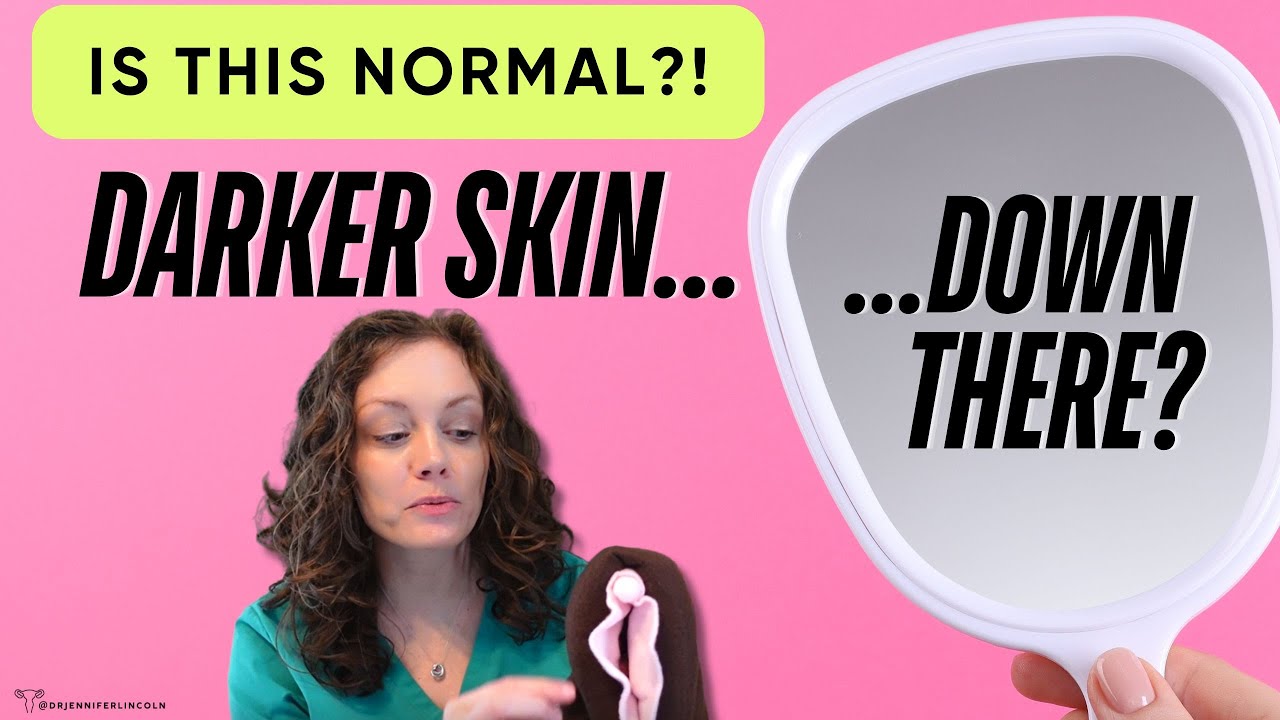 Is darker skin DOWN THERE *normal*?? Should you lighten it?? |  Dr. Jennifer Lincoln