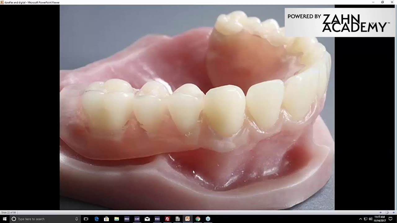 On-Demand Webinar: Myerson Duraflex Partials Step-By-Step
