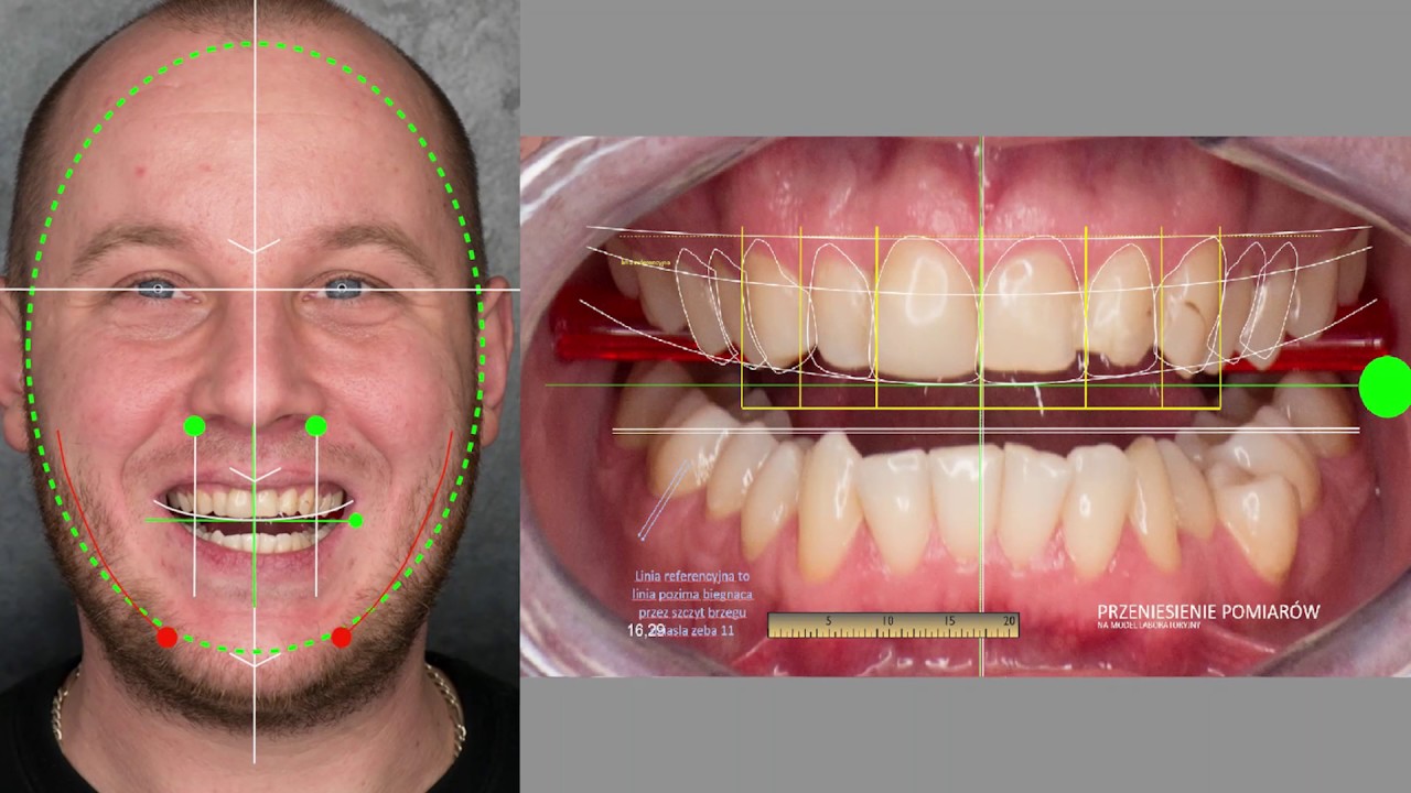 DIGITAL SMILE DESIGN