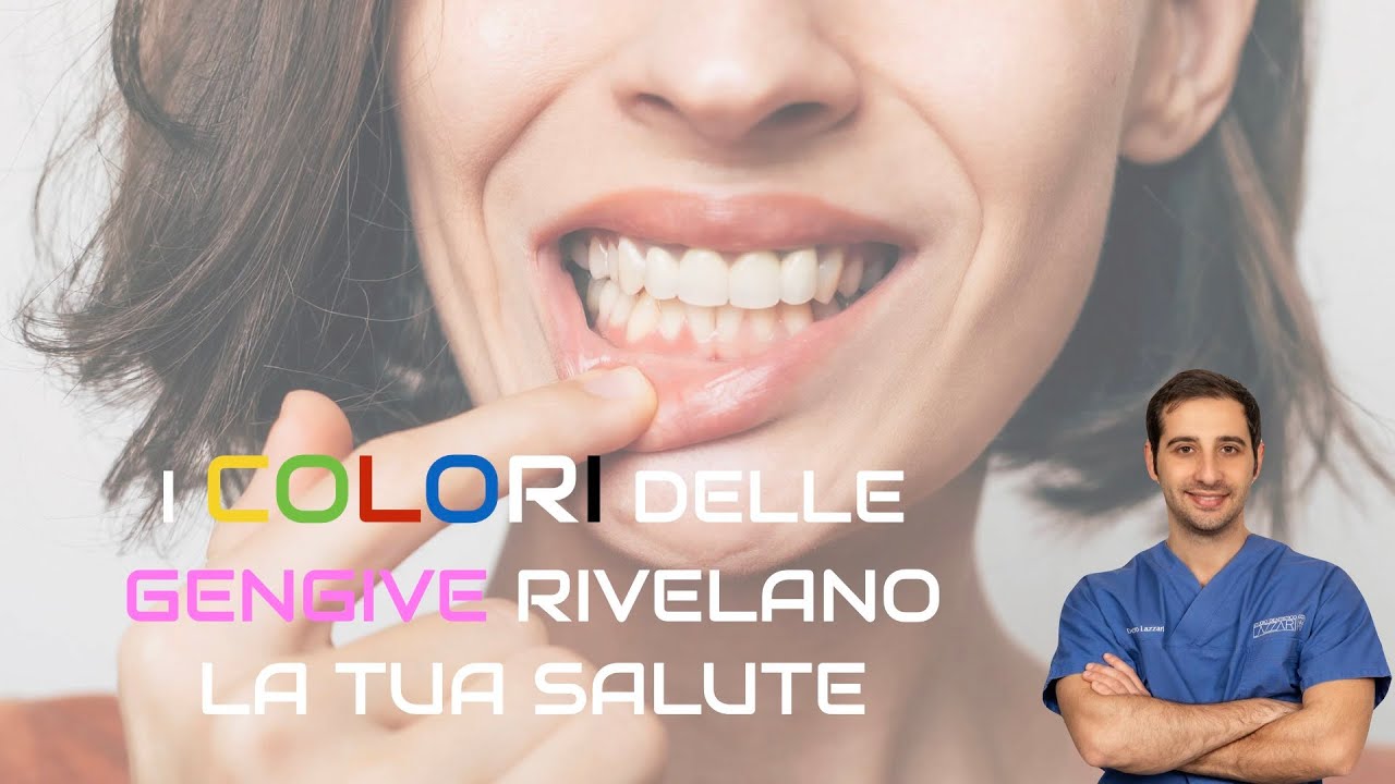 Il colore delle tue gengive nasconde un segreto sulla tua salute.