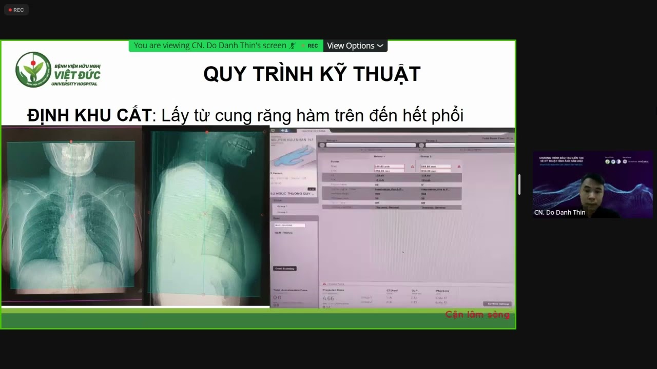 KỸ THUẬT CHỤP CẮT LỚP VI TÍNH DỰNG HÌNH KHÍ QUẢN TRÊN MÁY CT256 DÃY | CN. Nguyễn Tuấn Hải