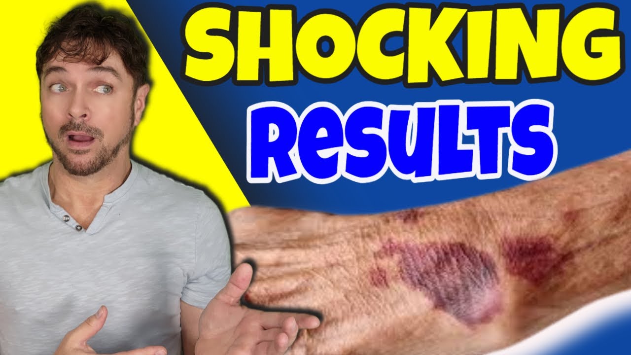 Два масла для ухода за кожей, которые останавливают проблемы старения! | Крис Гибсон