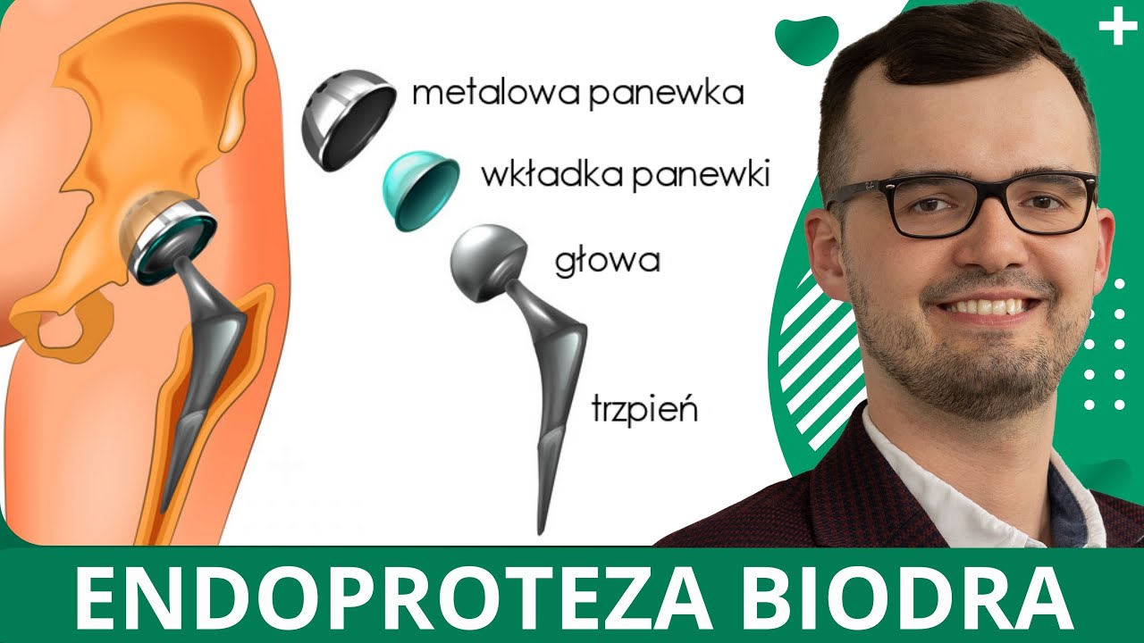 Endoproteza stawu biodrowego - budowa, badania przed i wskazania do wykonania operacji - czy czekać?