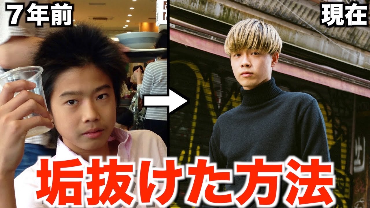 コムドットやまとがイケメンなった方法大公開！！！
