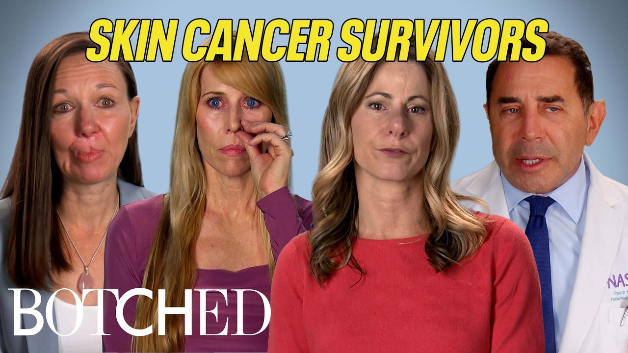 Skin Cancer Survivors: Self-Surgery, Rare Diagnoses, Lip Loss and More (Compilation) | Botched | E!