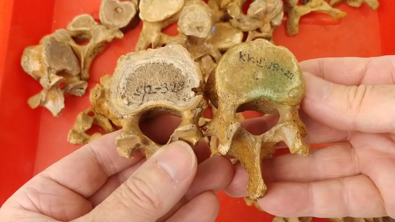 Anatomia w pigułce. Odróżnianie poszczególnych kręgów oraz kości kończyny prawej od lewej.