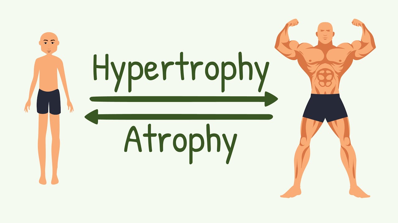 Remodeling of Muscle to Match Function | Hypertrophy, Hyperplasia, Atrophy, Changes in Muscle Length