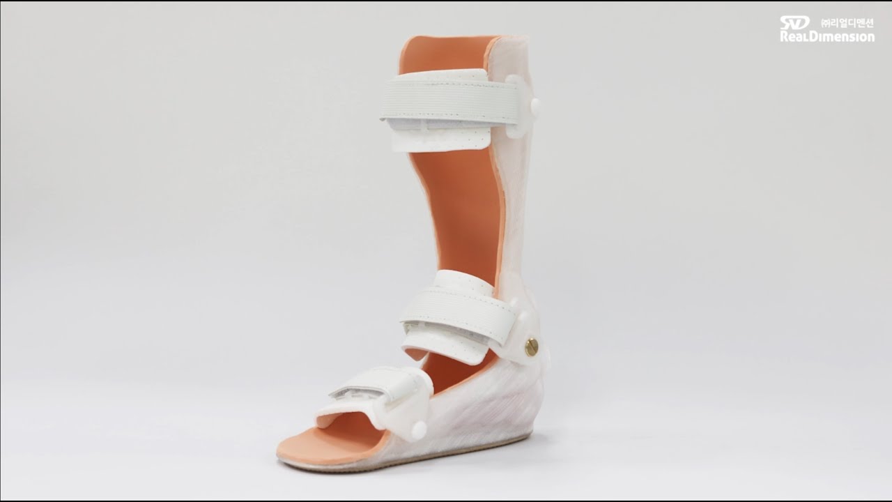 3D Printing and post-process of MediACE3D Hinged AFO
