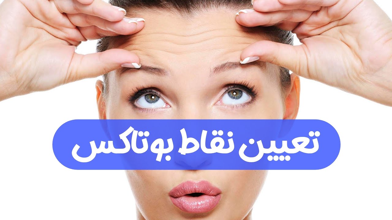 آموزش بوتاکس | جلسه سوم | تعیین نقاط بوتاکس