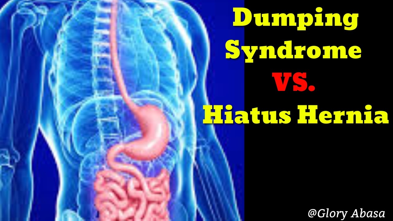 Dumping Syndrome vs. Hiatus Hernia: Key Differences & Management Explained!