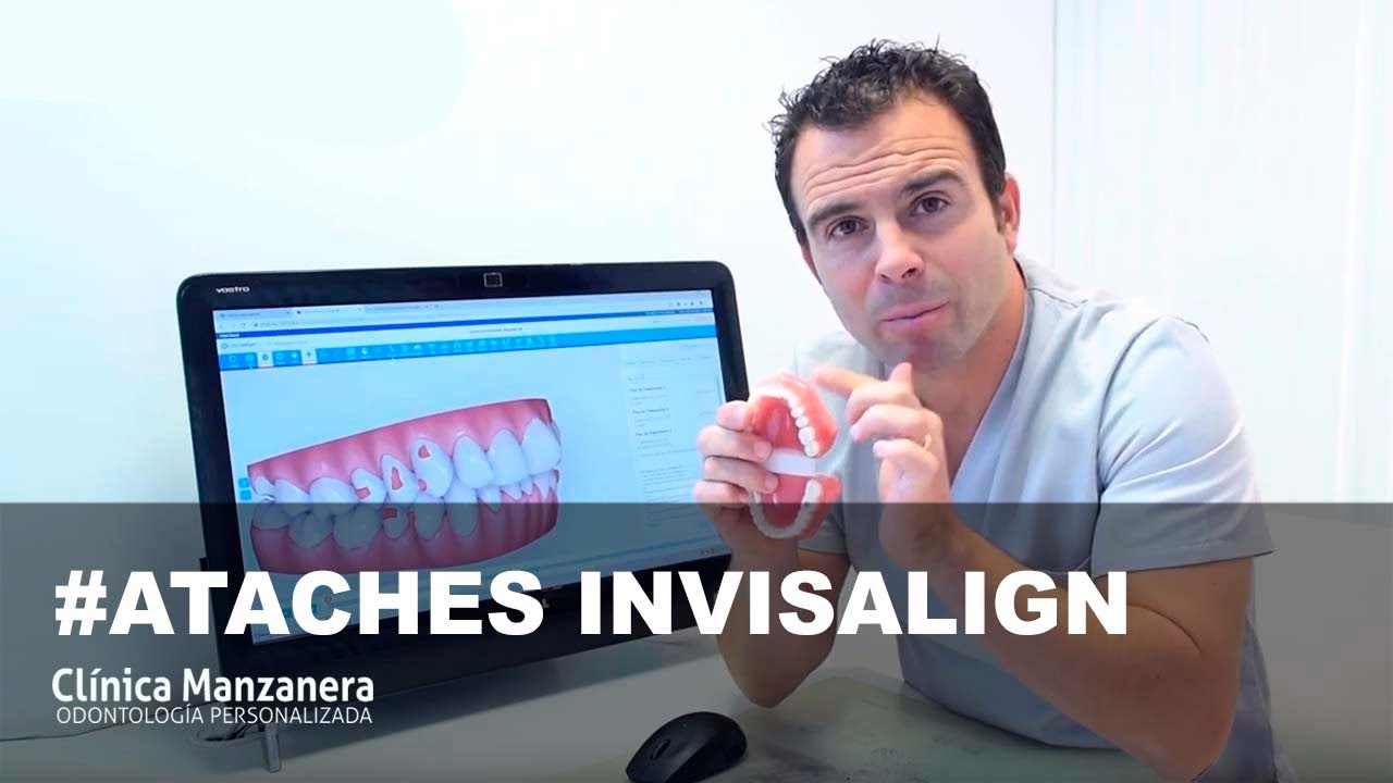 Ataches invisalign