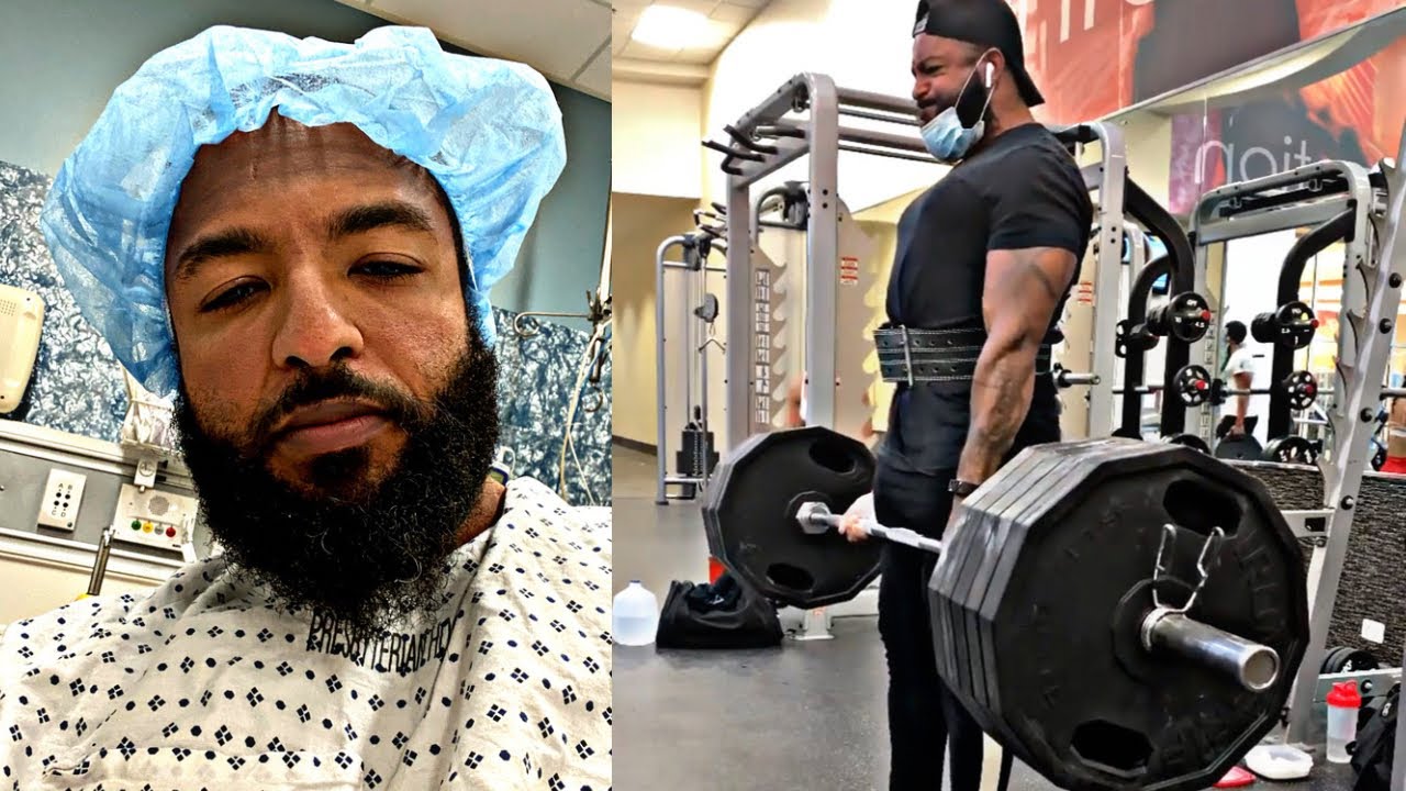 Lifting Weights After Back Surgery